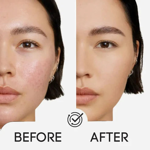 Toning Polish Pads - Korean Skincare for Dark Spots, Wrinkles & Dull Skin
