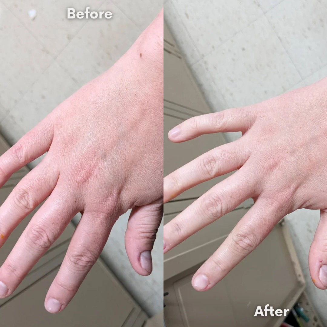 Reviva Lotion Bundle