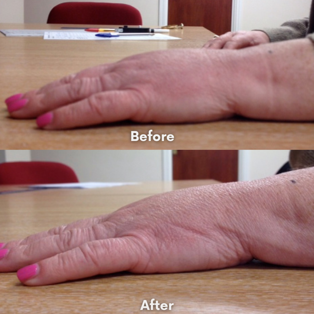 Reviva Lotion Bundle