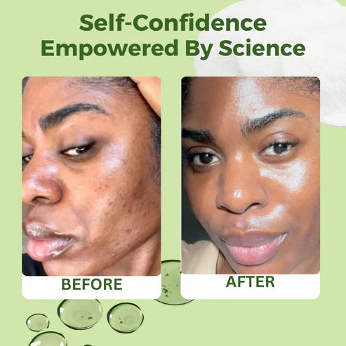 Toning Polish Pads - Korean Skincare for Dark Spots, Wrinkles & Dull Skin